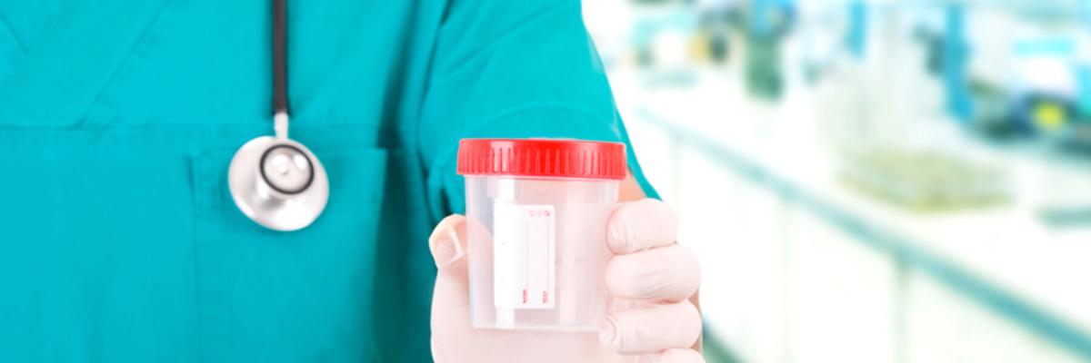 nurse or doctor holding a drug testing or screening cup, alcohol testing